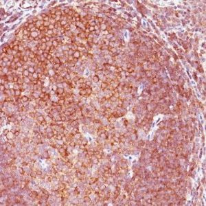 Monoclonal anti BCL 10 (BL10/411)