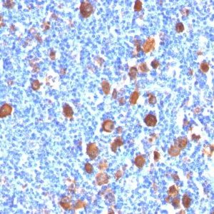 Monoclonal anti Fascin 1 (FSCN1/416)