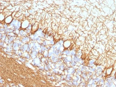 Monoclonal anti Neurofilament (NF H) (NF421)