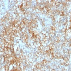 Monoclonal anti CD147 (8D6)