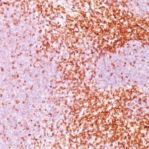 Monoclonal anti CD6 (3F7B5)