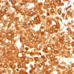 Monoclonal anti Pmel17 / gp100 / SILV (HMB45)