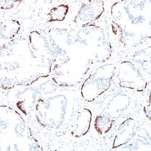 Monoclonal anti Cytokeratin, HMW (34BE12)