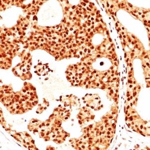 Monoclonal anti Estrogen Receptor beta 1 (ERb455)