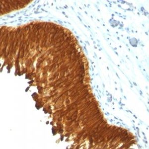 Monoclonal anti Cytokeratin, multi (KRT/457)