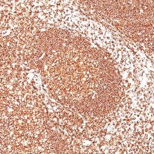 Monoclonal anti CD45 / LCA (2B11)