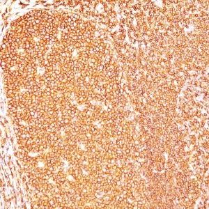 Monoclonal anti CD45RB (PD7/26)