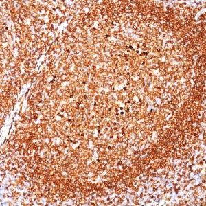 Monoclonal anti CD79a (JCB117)