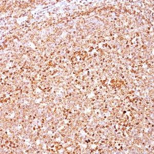 Monoclonal anti CD79a (HM47/A9)