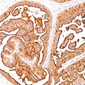 Monoclonal anti Mucin 1 / EMA / Episialin / CD227 (E29)