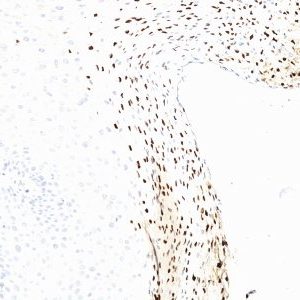 Monoclonal anti CDw60 (UM4D4)
