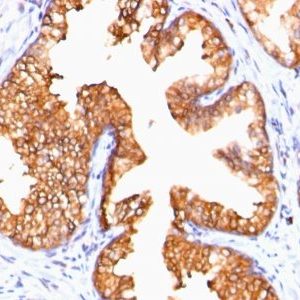 Monoclonal anti ODC 1 (Ornithine Decarboxylase 1) (ODC1/485)