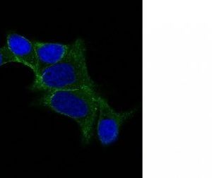 Monoclonal anti ODC 1 (Ornithine Decarboxylase 1) (ODC1/487)