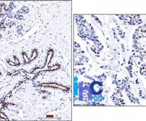 Monoclonal anti Progesterone Receptor (PR501)