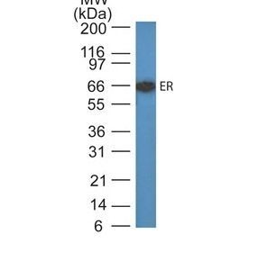 Monoclonal anti Estrogen Receptor (ER505)