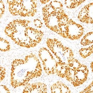 Monoclonal anti p53 (DO 7)