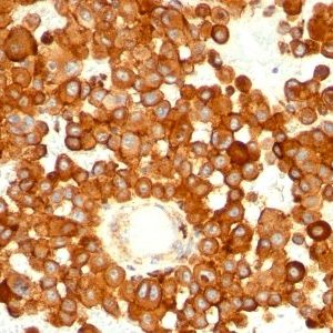 Monoclonal anti CD63 (MX 49.129.5)