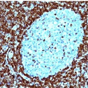 Monoclonal anti bcl 2 (124)