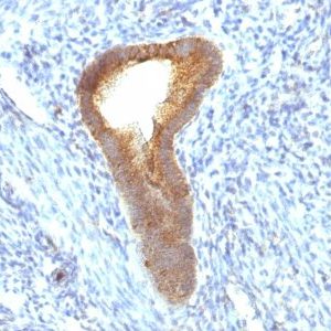 Monoclonal anti Alkaline Phosphatase (ALP/597)