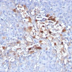 Monoclonal anti CD146 / MCAM / MUC18 / Mucin 18 (C146/634)