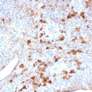 Monoclonal anti Lambda Light Chain (LAM03)