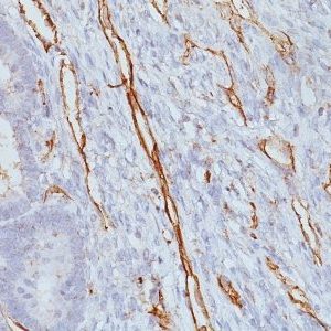 Monoclonal anti CD31 / PECAM 1 (JC/70A)