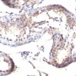 Monoclonal anti TGFalpha (MF9)