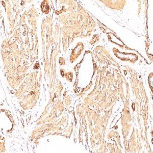 Monoclonal anti Smooth Muscle Actin (1A4)