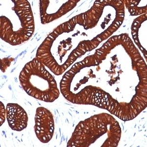Monoclonal anti Cytokeratin 19 (BA17)