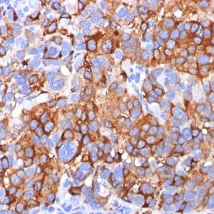 Monoclonal anti MART 1 / Melan A (A103)