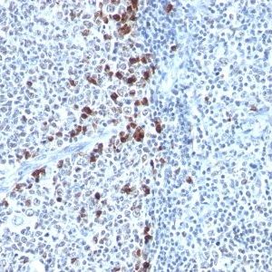 Monoclonal anti Kappa Light Chain (HP6053)