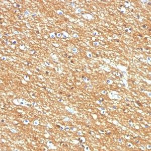 Monoclonal anti CD56 / NCAM (123A8, same as 56C04)