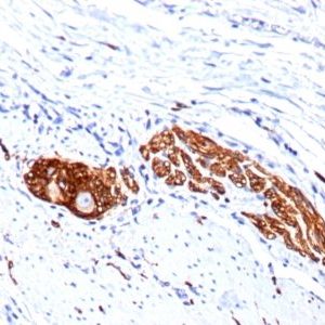 Monoclonal anti CD56 / NCAM (123C3.D5 + 123A8)