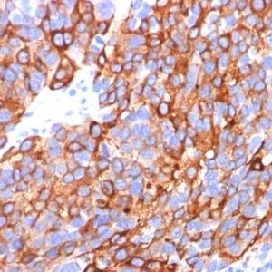 Monoclonal anti MART 1 / Melan A (M2 7C10 + M2 9E3 + A103)