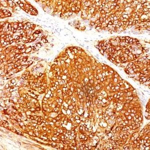 Monoclonal anti Melanoma Marker (HMB45 + A103 + T311)