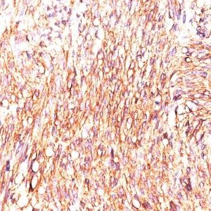 Monoclonal anti DOG 1 (DOG1.1)