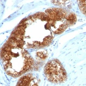 Monoclonal anti TAG 72 / CA72.4 (B72.3 + CA72/733)