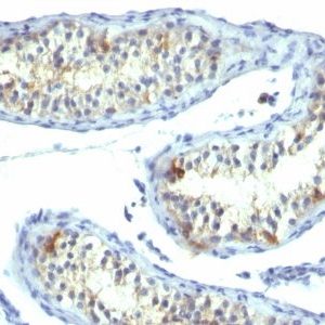 Monoclonal anti Prolactin Receptor (B6.2)