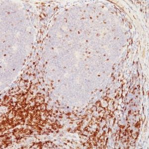 Monoclonal anti CD5 (CD5/54/F6)