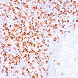 Monoclonal anti CD8 (C8/144B)