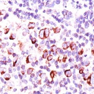 Monoclonal anti bcl x (BX006 + 2H12)