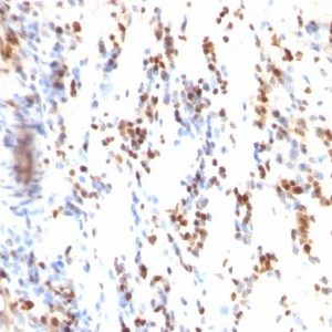 Monoclonal anti p27 / KIP1 (KIP1/769)