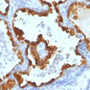 Monoclonal anti Cytokeratin 8/18 (C 43 + DC10)