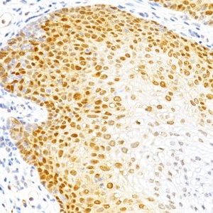 Monoclonal anti p27 / KIP1 (DCS 72.F6)