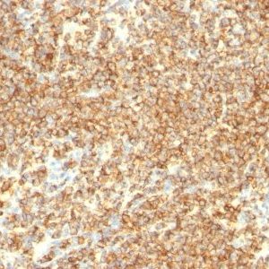 Monoclonal anti CD20 (IGEL/773)