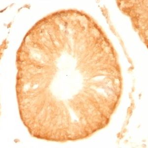 Monoclonal anti pgp9.5 (UCHL 1) (UCHL1/775)