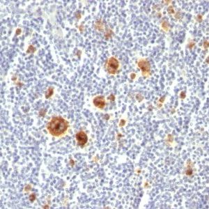 Monoclonal anti CD30 (Ki 1/779)
