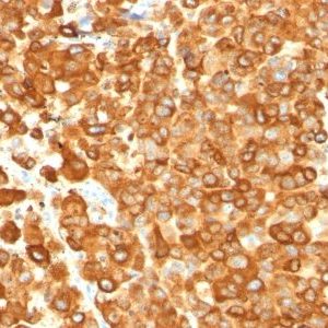 Monoclonal anti Pmel17 / gp100 / SILV (PMEL/783)