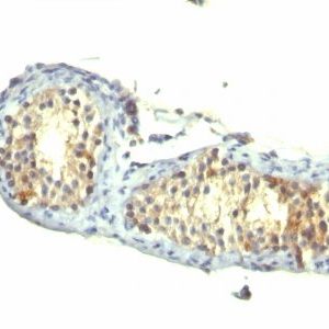 Monoclonal anti TGFalpha (1E8 G6)