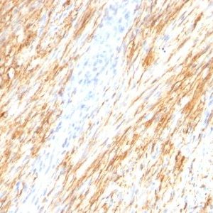 Monoclonal anti GFAP (ASTRO/789)